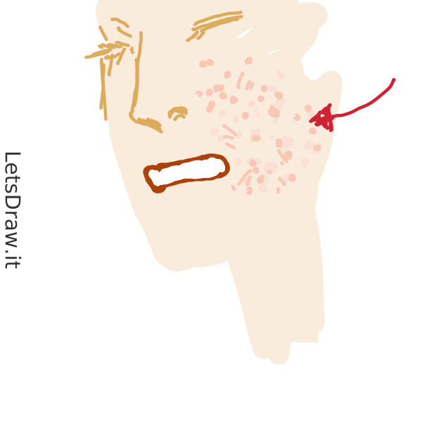 How to draw acne / 3nd6xf8ex.png / LetsDrawIt